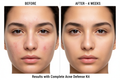 Before After Comparison