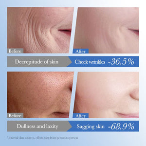 SADOER Caviar Hyaluronic Acid Anti-Aging Repair Moisturizing Cream