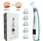 Vacuum blackhead remover with packaging and before-after illustration on a white background