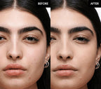 Before and after comparison of a woman's face with visible skin improvement.