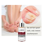 LANBENA nail repair essence bottle with a close-up of a foot and nail issue on a white background.