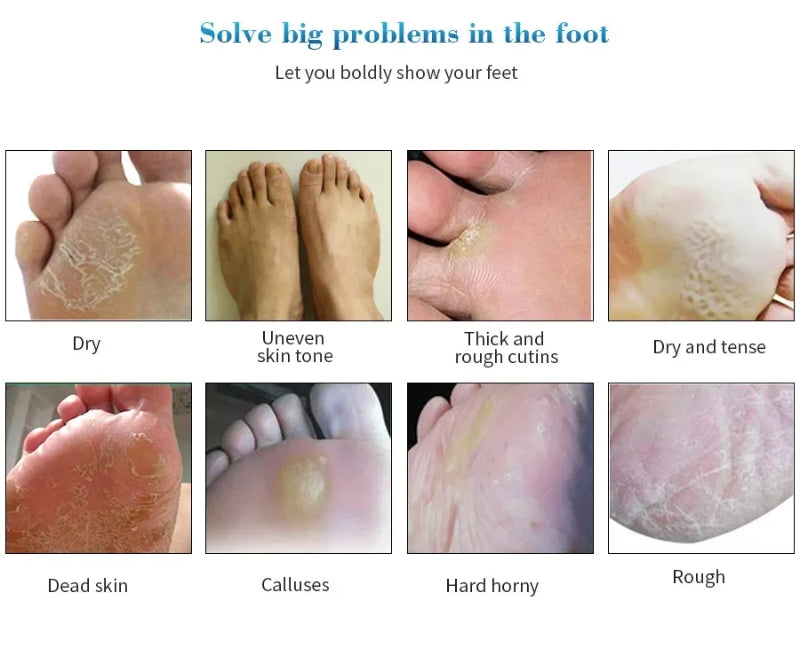 Foot care product advertisement showing various foot issues and solutions.