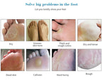 Foot care product advertisement showing various foot issues and solutions.