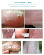 Collage of images showing the effect of a skin treatment on feet, with text about cuticle removal.