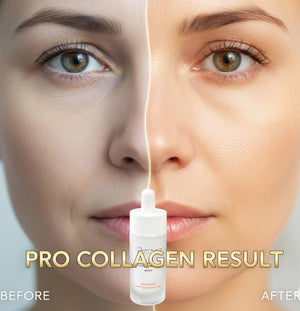 Before and after comparison of a woman's face with Pro Collagen Result product.