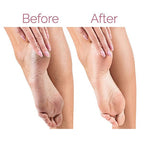 Before and after comparison of feet with calluses on a white background