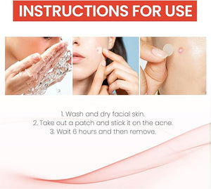 Acne Cover Patch (72pc) - Ultra-Thin Invisible Hydrocolloid Pimple Patches