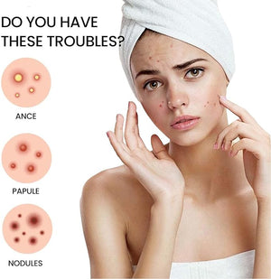 Acne Cover Patch (72pc) - Ultra-Thin Invisible Hydrocolloid Pimple Patches